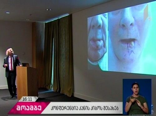 International Medical Conference ongoing in Tbilisi
